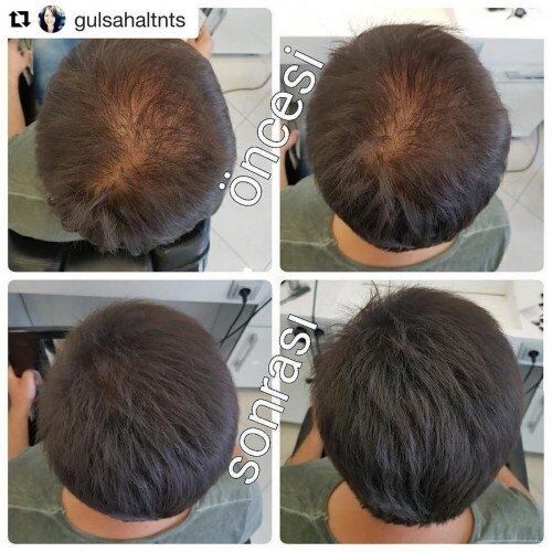 Luis Bien Hair Fiber Koyu Kahve Saç Sprey 100 Ml