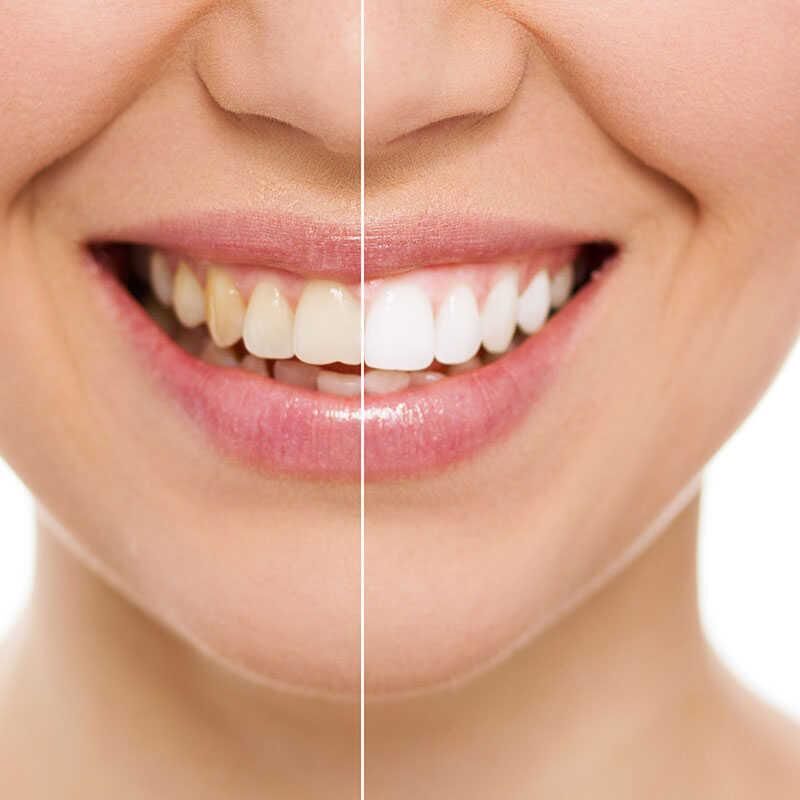 Smokers Beyazlaştırıcı Diş Tozu 55g - Naturel