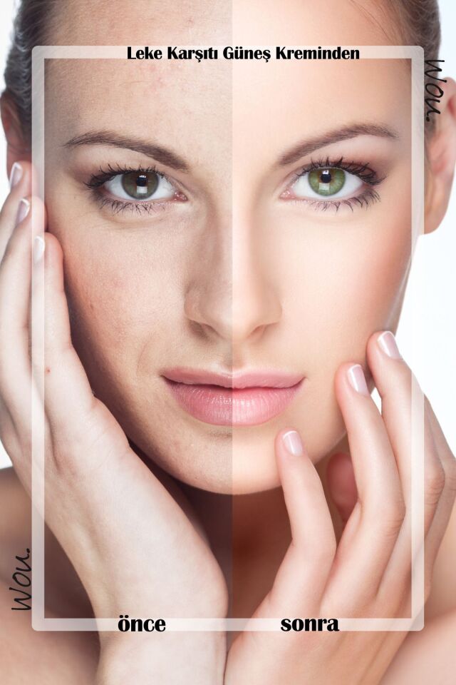 Wou Leke Karşıtı Yüksek Koruma Güneş Kremi Spf50 Yüksek Korumalı Güneş Kremi 50 ML