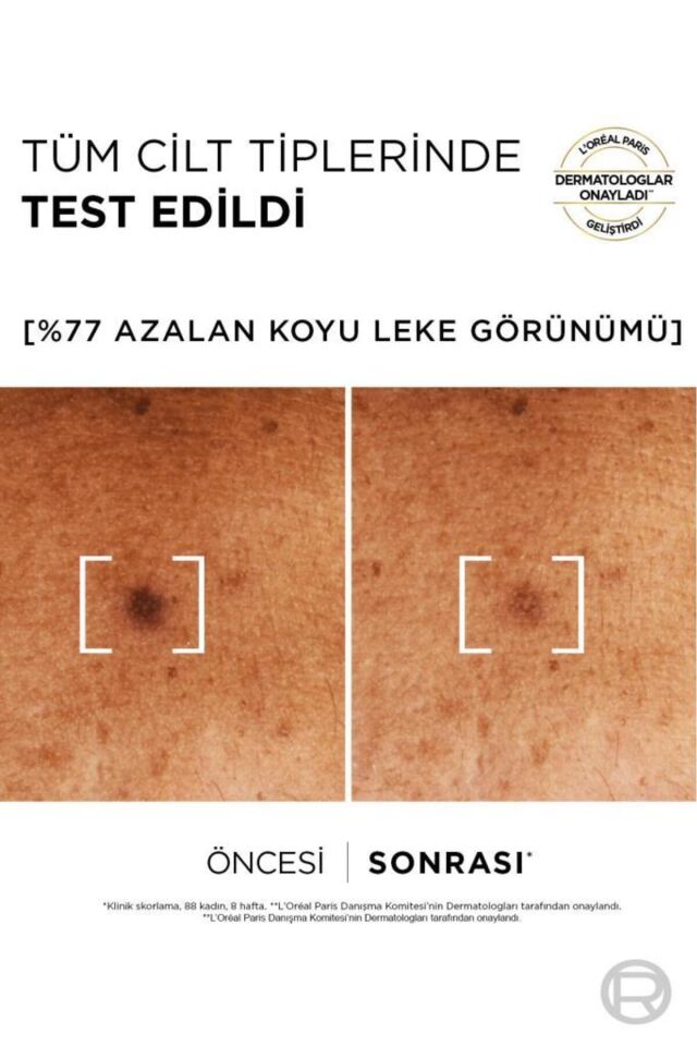L'Oreal Paris Bright Reveal Sivilce, Güneş, Yaşlanma Lekelerinde Etkili Koyu Leke Karşıtı Serum, 10% Niasinamid, 30 ml