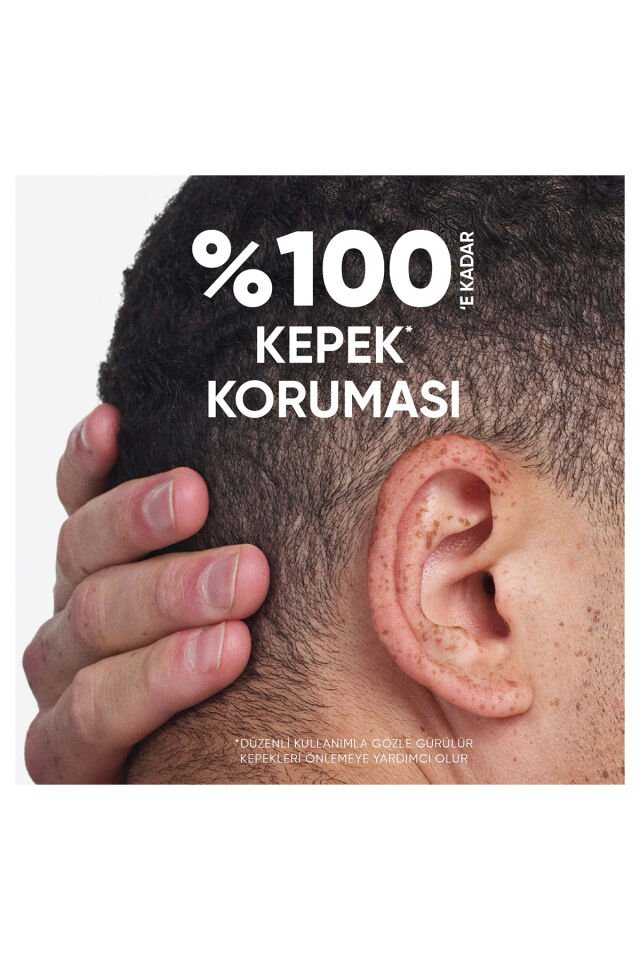 Head Shoulders 2ın 1 Şampuan 300 Ml Mentol Freahlığı+ Kepek